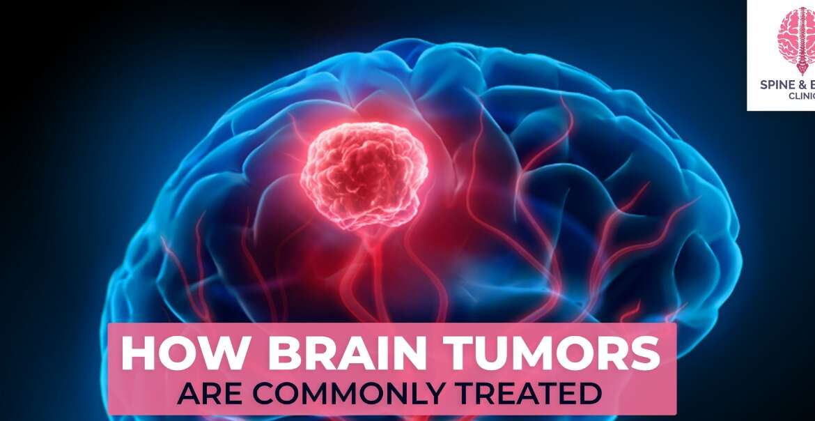 How Brain Tumors Are Commonly Treated?