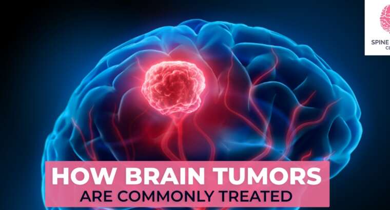 How Brain Tumors Are Commonly Treated?