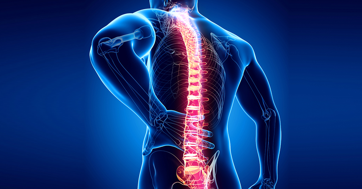 Understanding Spinal Stenosis 